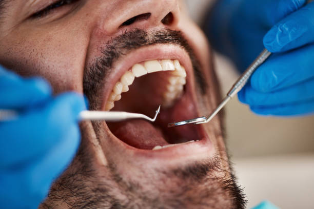 Best Emergency Root Canal Treatment in Bluffton, SC